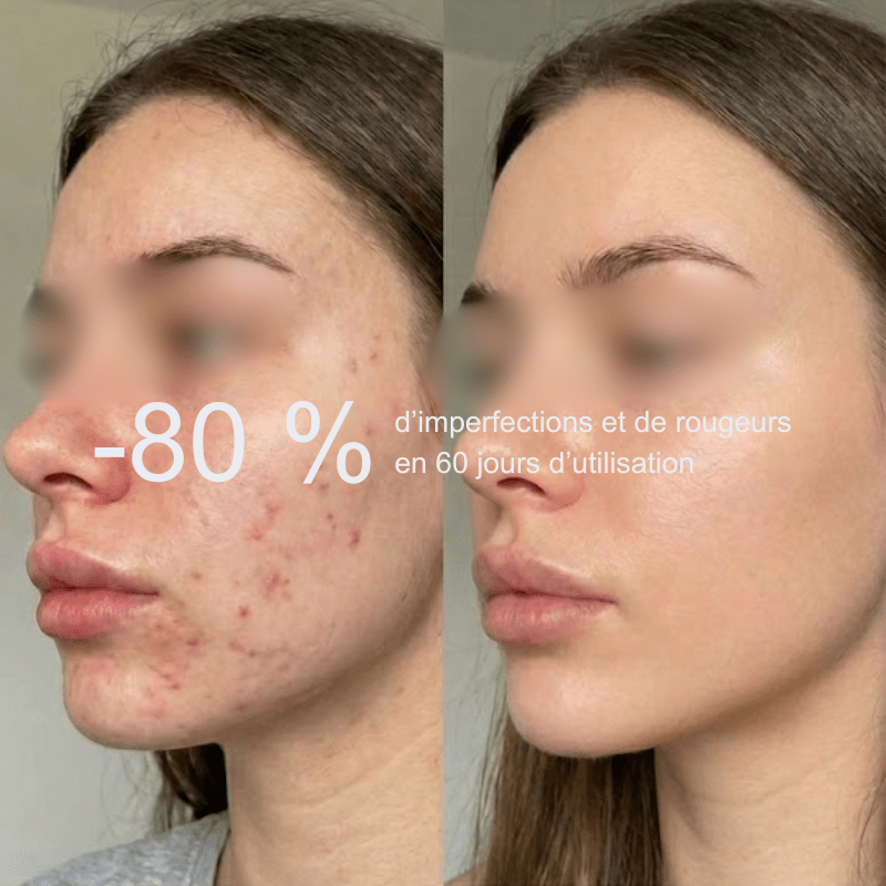 Pommeau de Douche Filtrant - Sensivaé